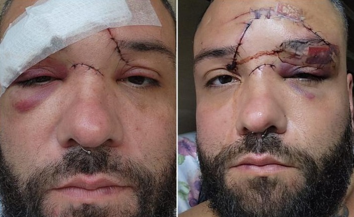 Designer de moda gay é violentamente agredido em Mesquita, no Rio de Janeiro