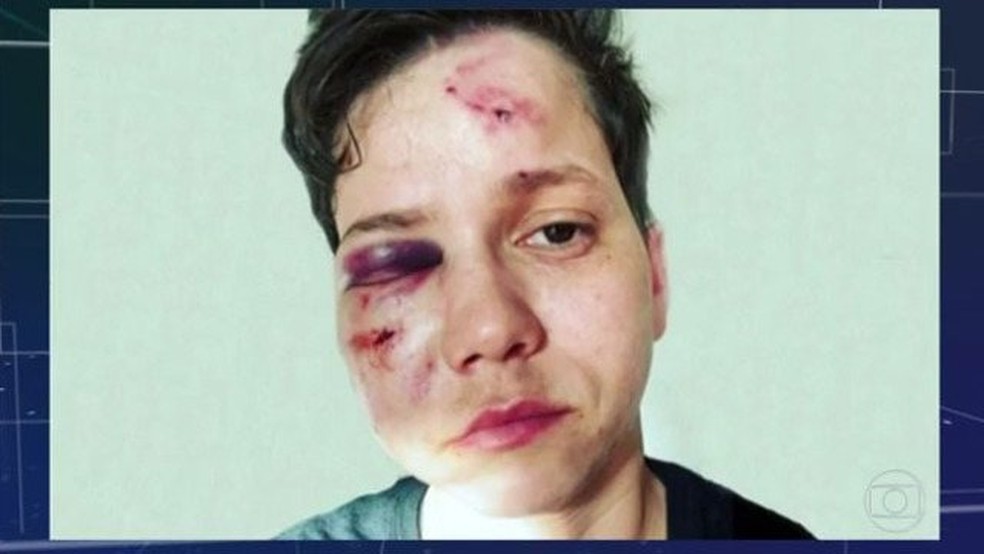 Youtuber lésbica bolsonarista Karol Eller é denunciada por lesão corporal