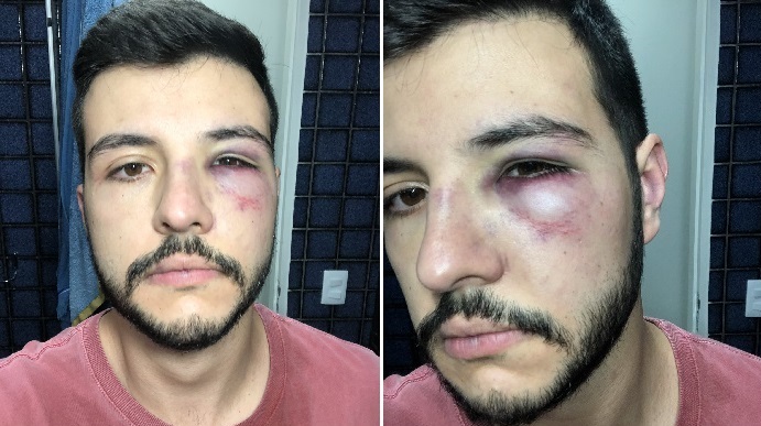 Matheus Ribeiro: jornalista gay é agredido em assalto em Brasília