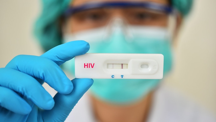 teste hiv